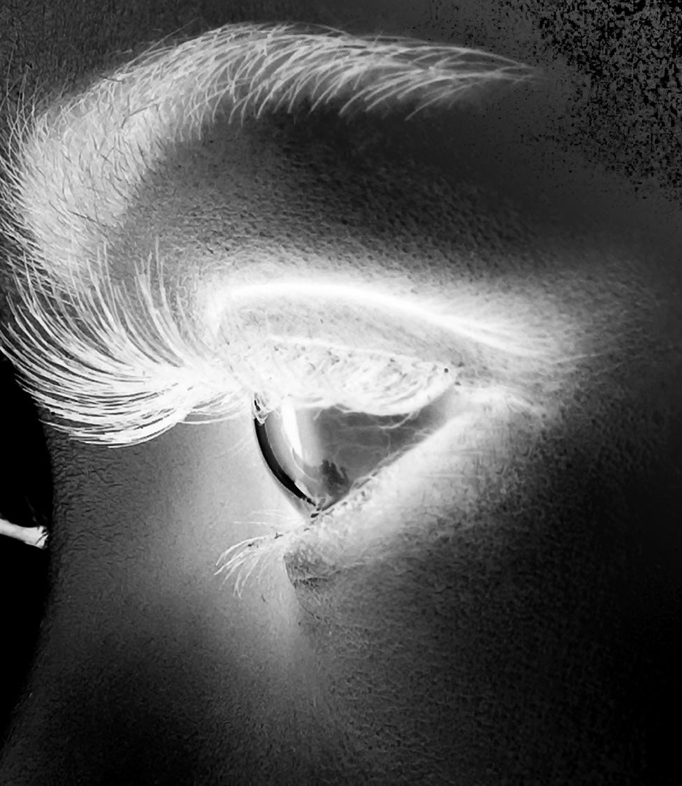 New Visions Xray