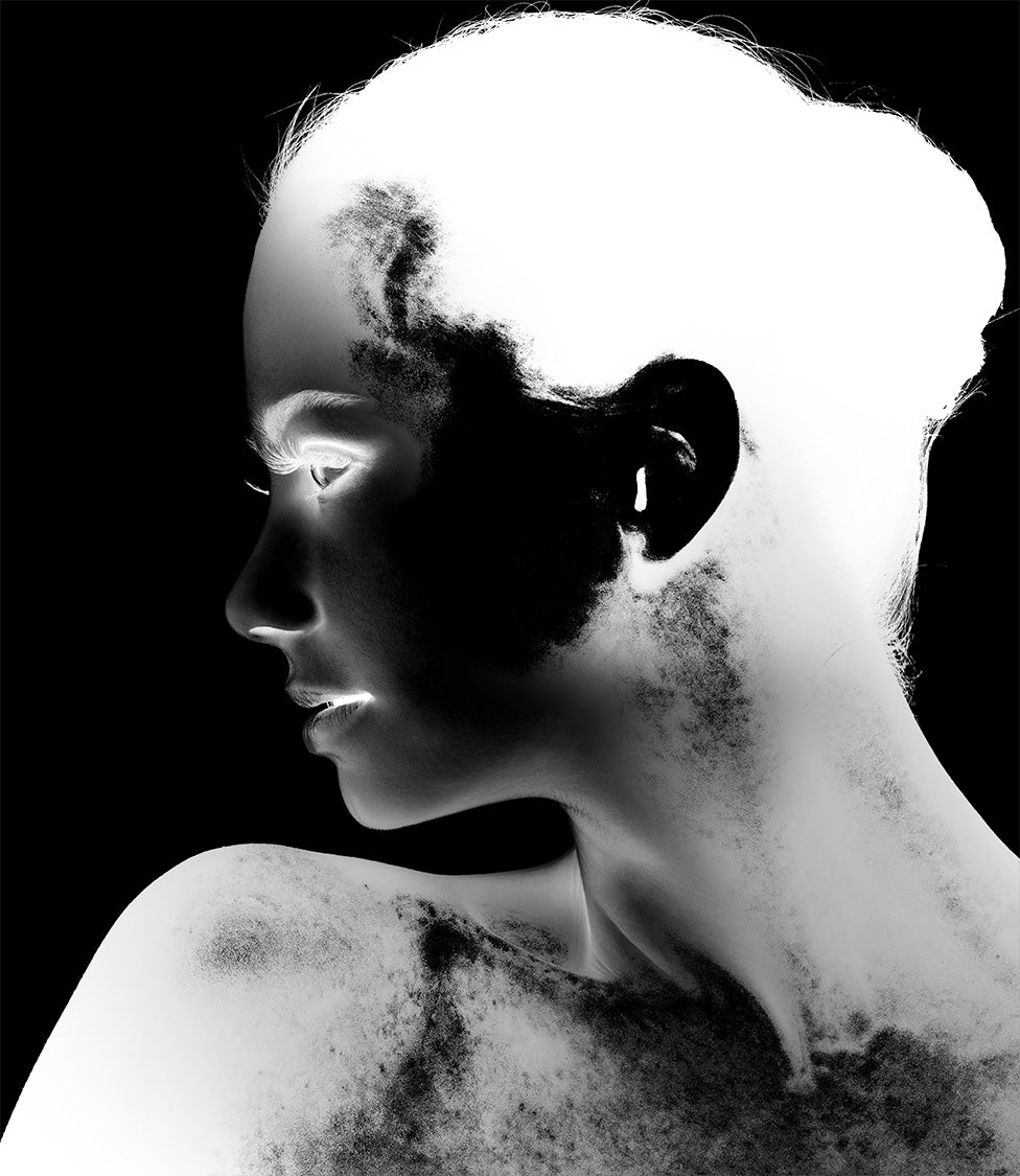 New Visions Xray